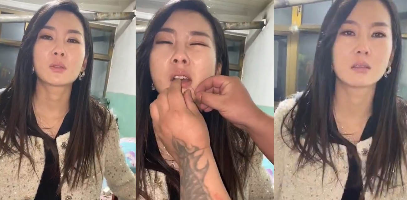 两女PK惩罚被主人把嘴缝在一起 过程居然毫无反抗 钢针刺进嘴巴看着都痛 不说还以为是缅北园区新惩罚呢！ - 51吃瓜网-51吃瓜网